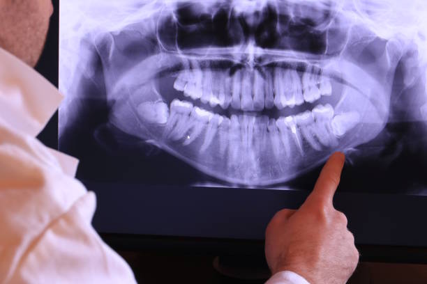 Best Emergency Treatment for Toothache in Cecilia, LA