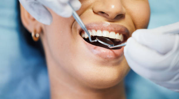 Best After-Hours Emergency Dentist in Cecilia, LA